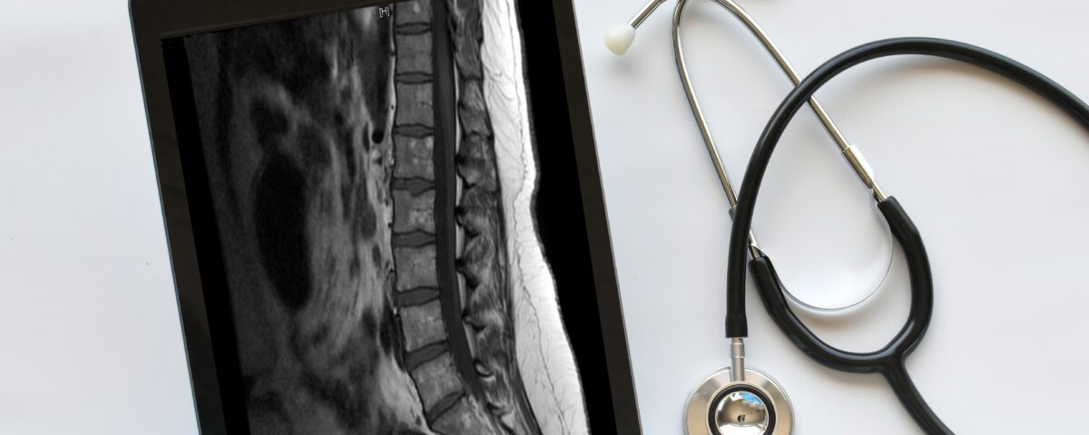 doctor medical professional technician using a ipad tablet to view read mri results e1699546450506