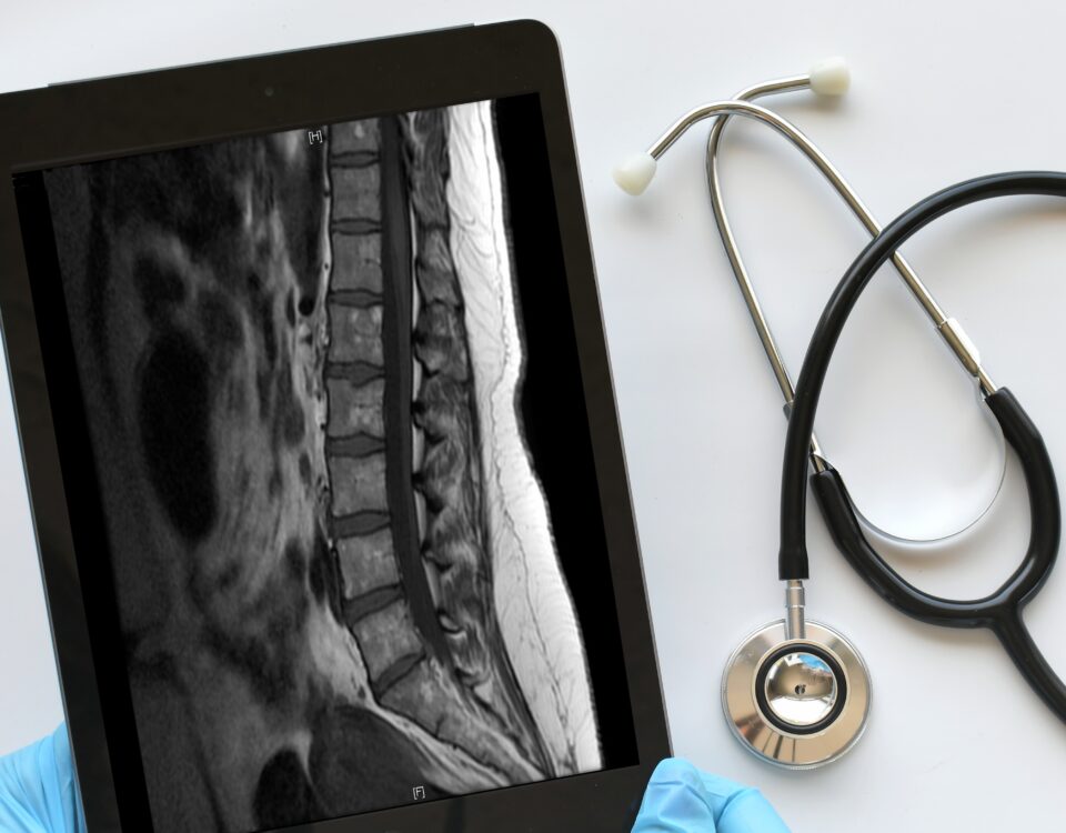 doctor medical professional technician using a ipad tablet to view read mri results e1699546450506