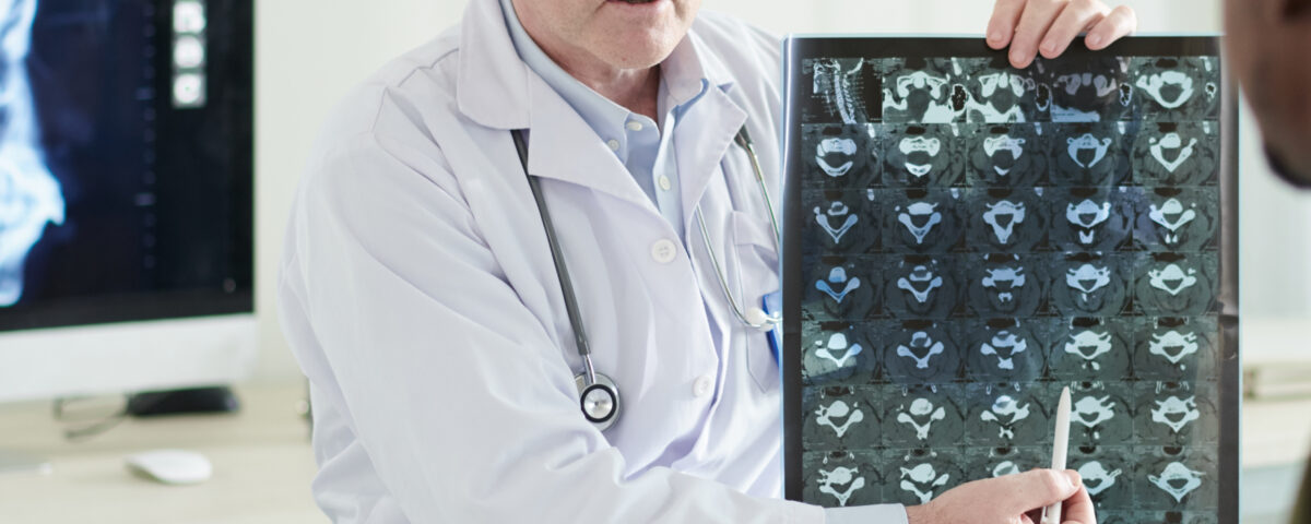 progression of herniated discs e1699989385986