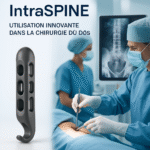 IntraSPINE® à Lévis : procédure mini-invasive approuvée 5 découvrez comment l’implant intraspine® à sherbrooke permet une récupération rapide et efficace après une chirurgie du dos. profitez d’une technologie innovante pour retrouver mobilité et confort.